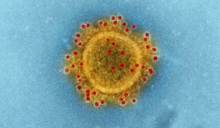 Tiga RSUD di Tangerang Disiagakan Hadapi Potensi Kasus Hantavirus